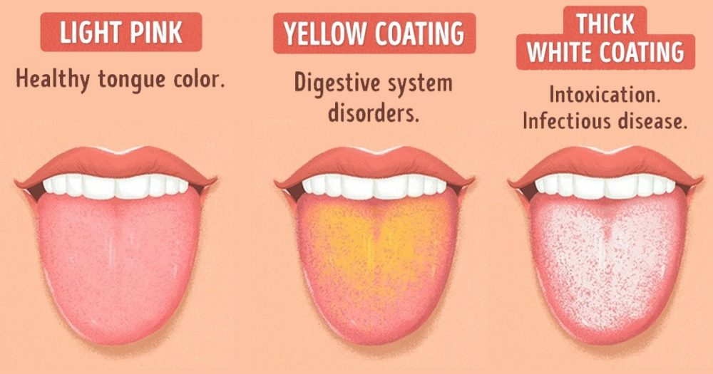 healthy tongue pictures vs unhealthy