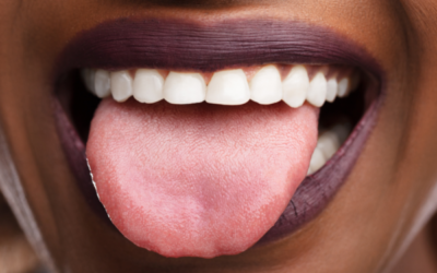 Analyzing Your Health Through Your Tongue